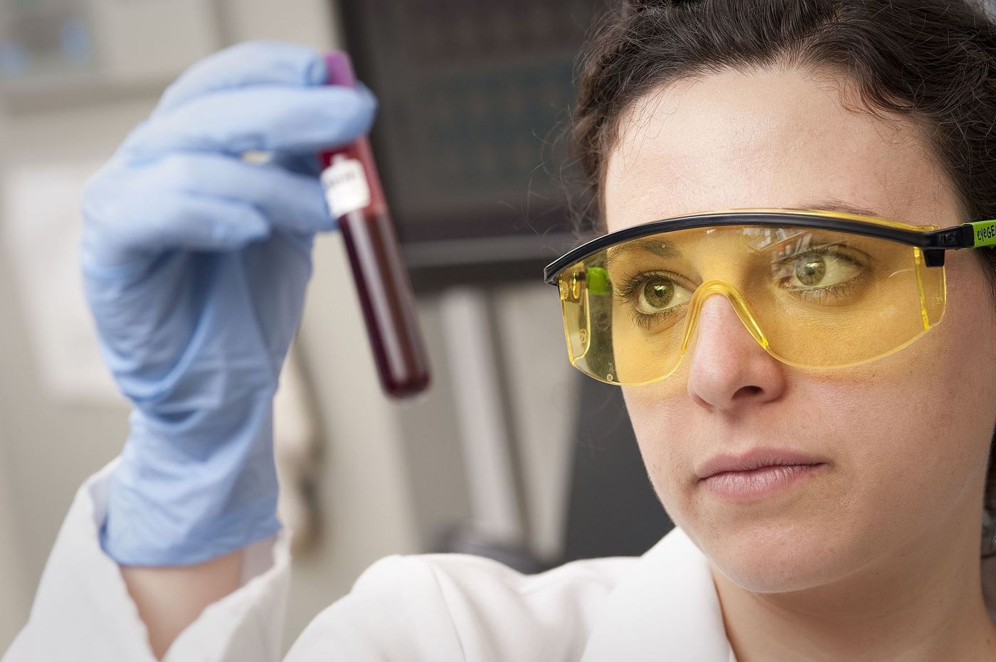 A blood sample in a laboratory